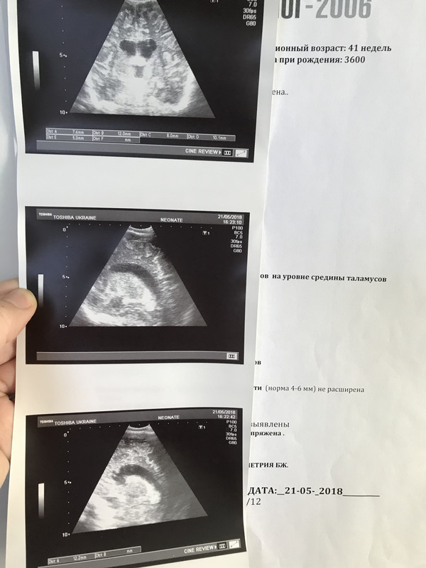 D8657C13-3A38-4955-A0D7-E600A5DC864E