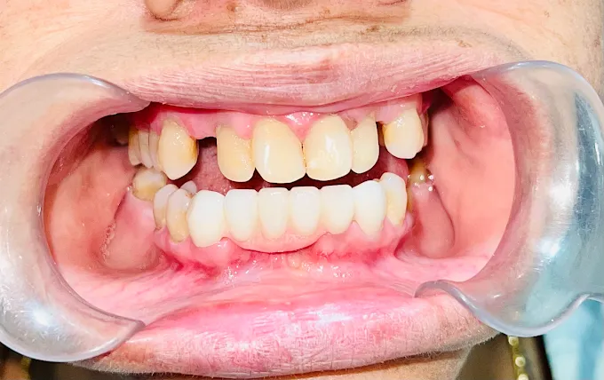 Dental procedure before after comparison CTM