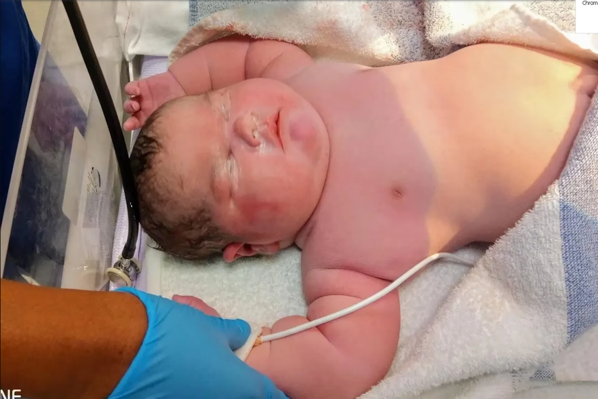 ¿Qué pasa si el recién nacido pesa 4 kilos?