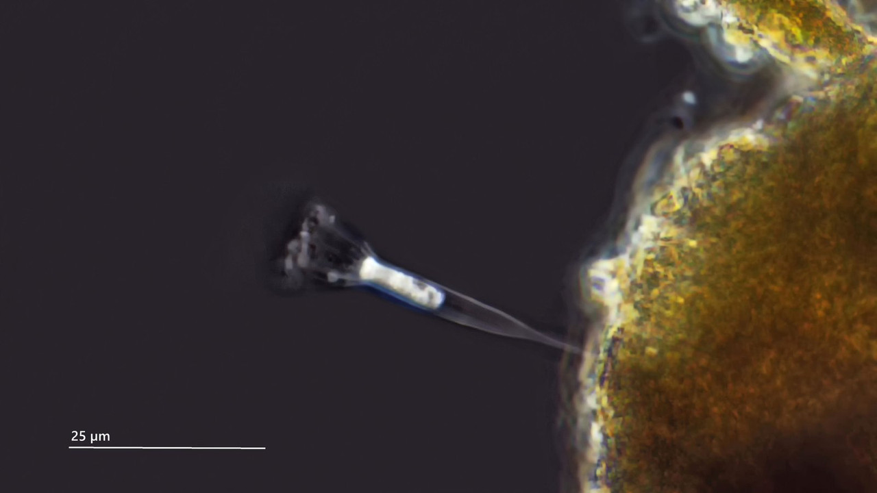 Salpingoeca 03 vaginicola (oder gracilis) Gehäuse-Flag PH neg 50 Stack 2