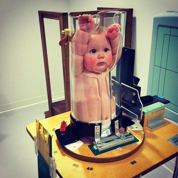 baby-xray
