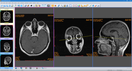 Sante DICOM Viewer 3D Pro 4.9.4 Portable