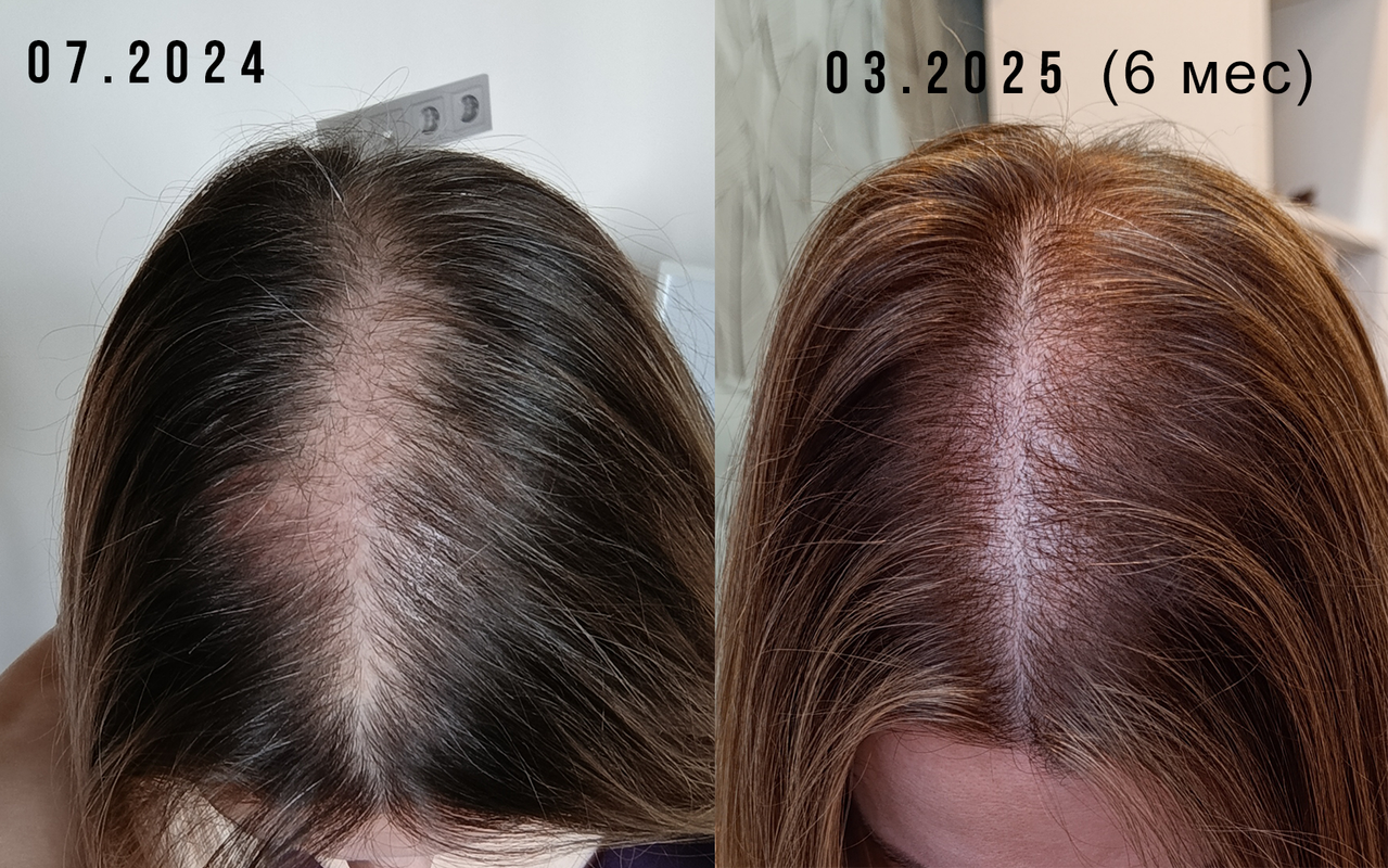 00 до после 6 м дома