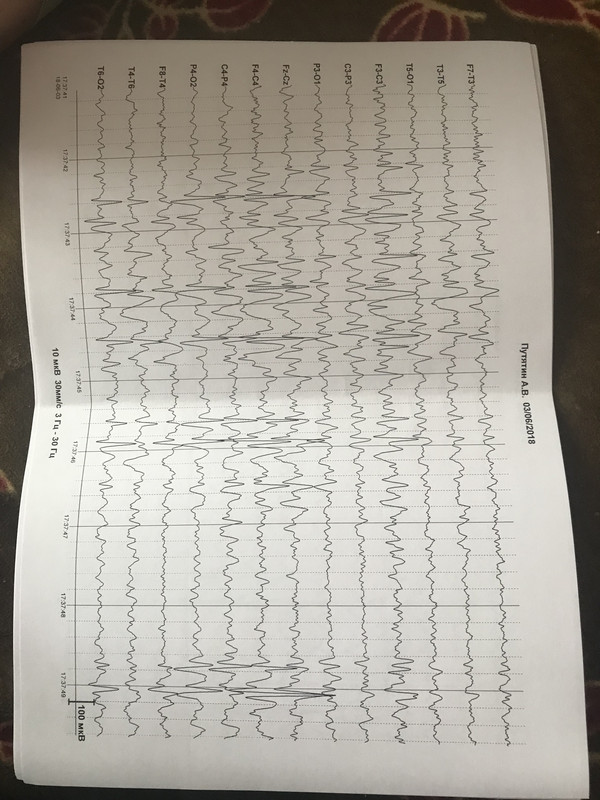 C4FFAF64-7A3A-4D7A-B50A-6EFE419D368D