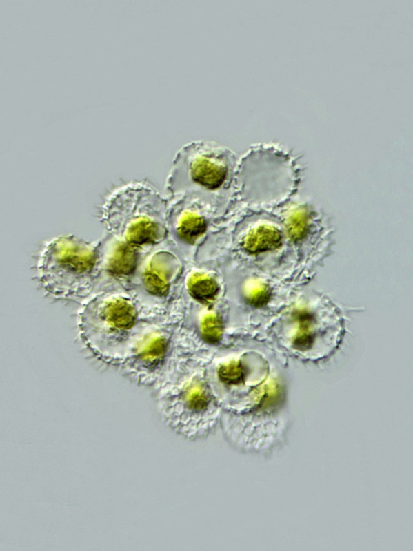 Synura 16 sphagnicola Goldkugel sechseckige Schuppen (abgestorben) DIK 100 Hochmoor Arzmoos-Z7