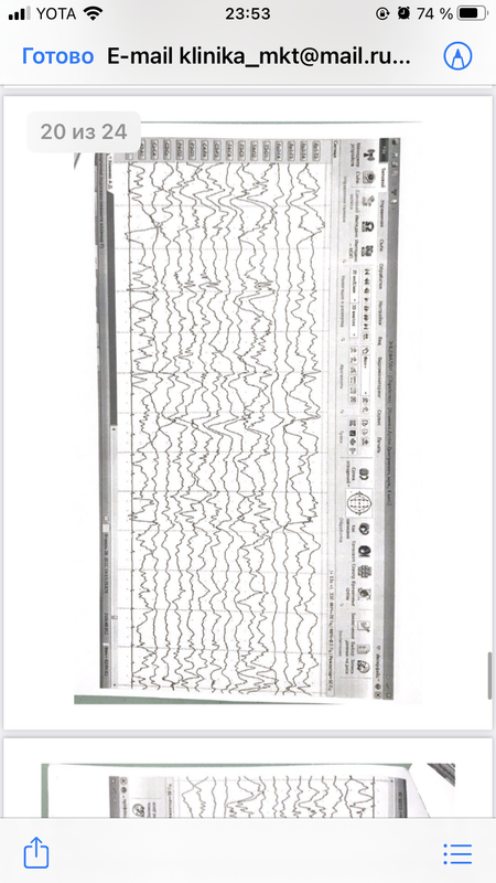 79BE8FDA-66AF-4DB6-B9EA-3C6571C3F1B4