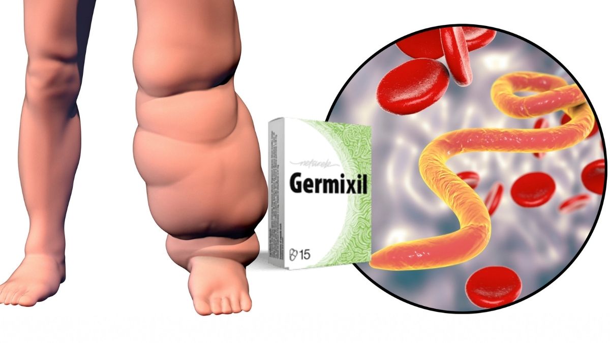 germixil