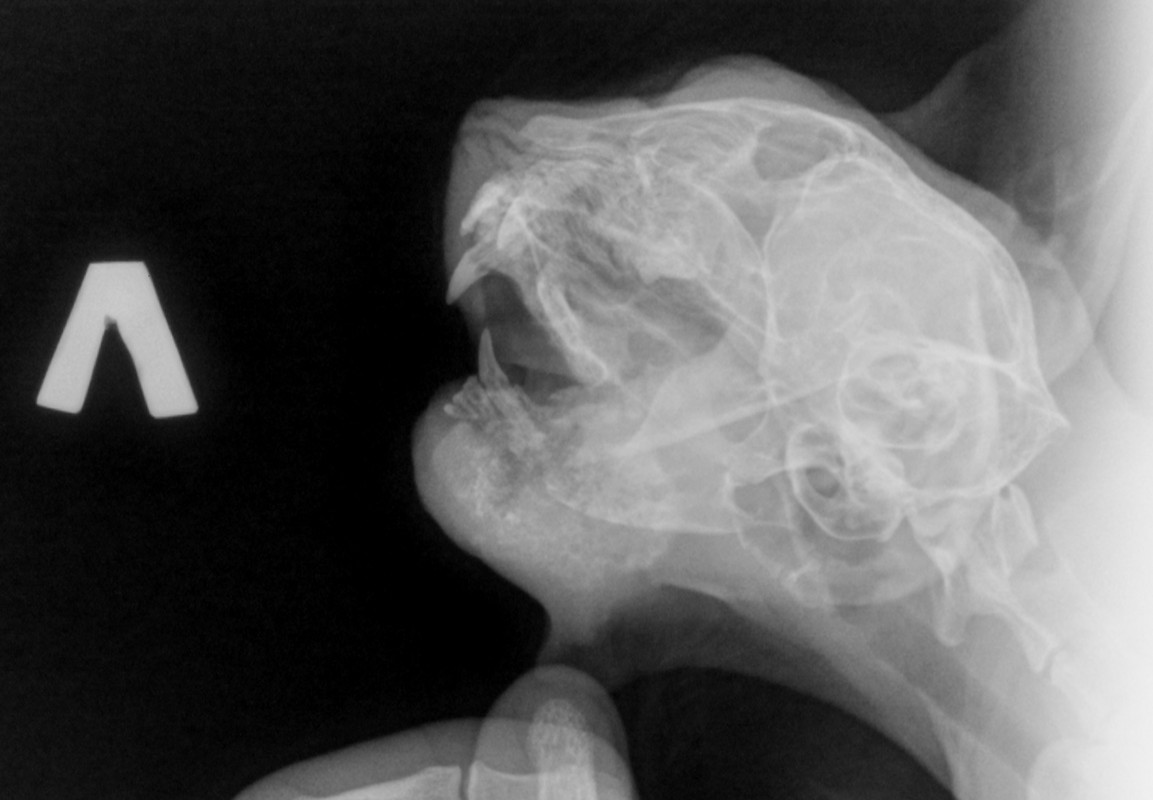 рентген-челюсть