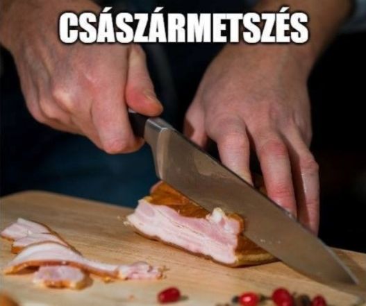 https://i.postimg.cc/pXbdP377/csaszarmetszes.jpg