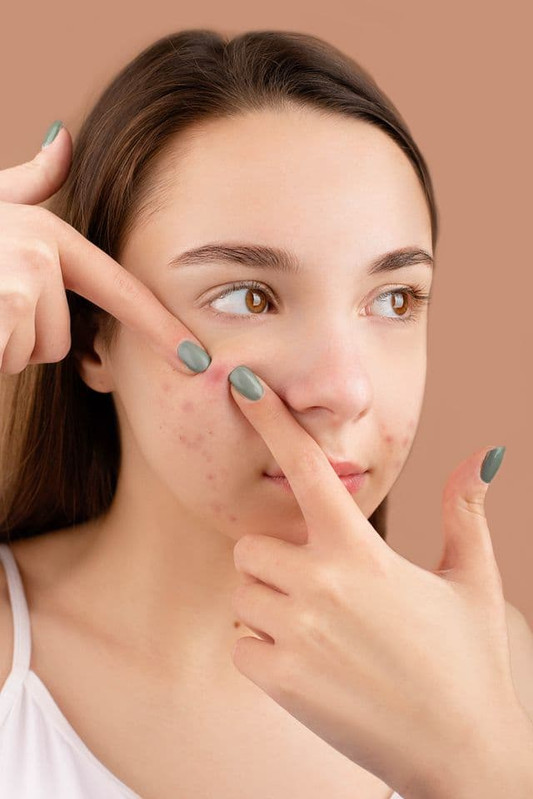 poor gut health can leads to acne and breakouts on the skin.