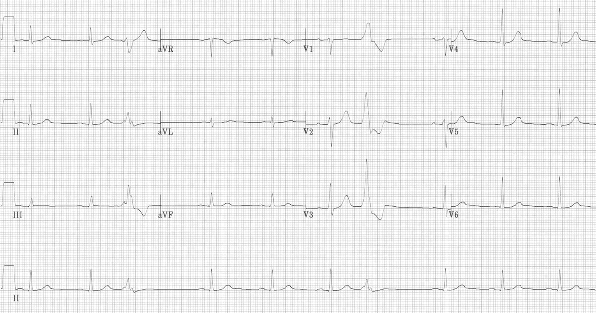 Cardiology question 7 image