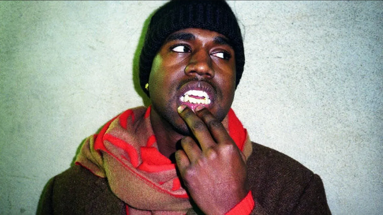 ¿Qué fue lo que le pasó a Kanye West en la mandíbula?