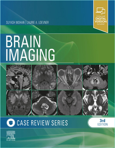 Loevner L Brain Imaging Case Review Series 3ed (2024)