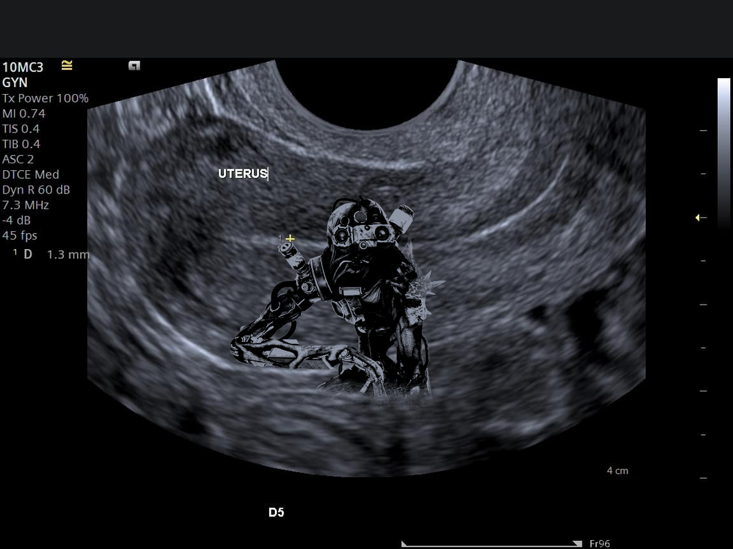 a transparent picture of the singularity from dbd edited onto a picture of a uterus in an ultrasound.