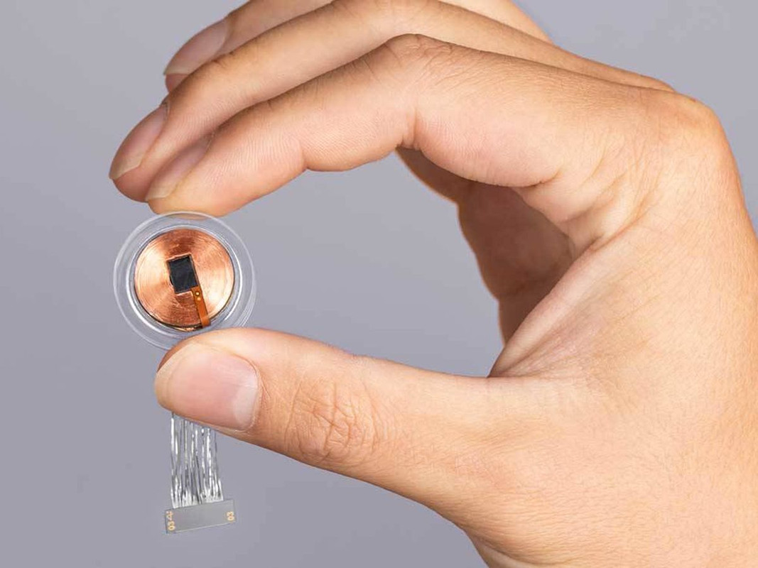 Estudiante se implanta un dispositivo Bluetooth para hacer trampa en el examen