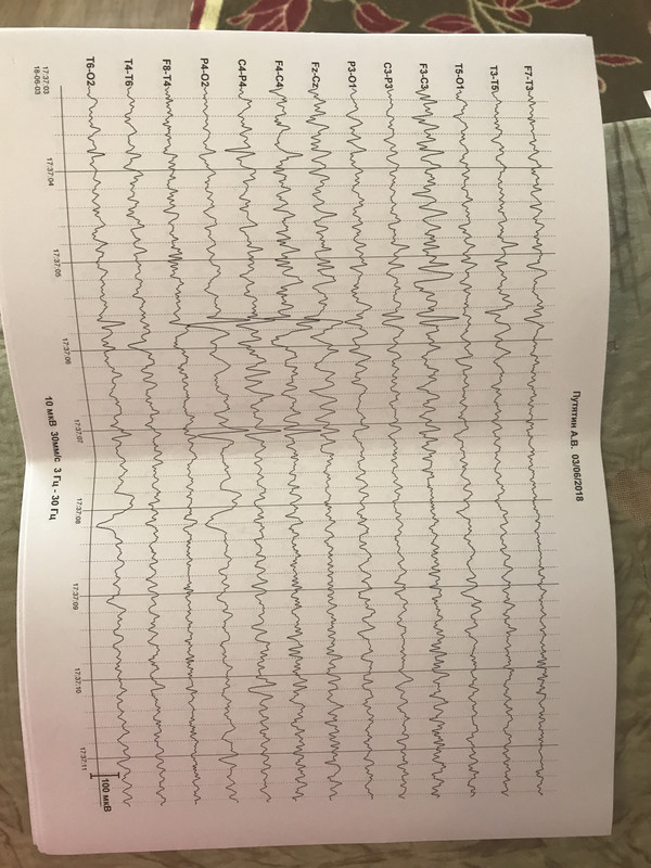 F959453B-170E-4CCD-96E6-7B0AB8CFD79C