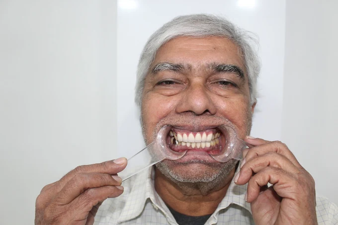 Dental restoration work completed at CTM clinic