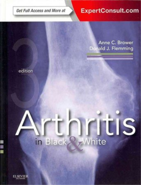 Arthritis in Black & White, 3rd Edition