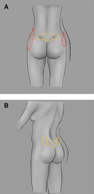 10-1055-s-0042-1749099-i2140992-2