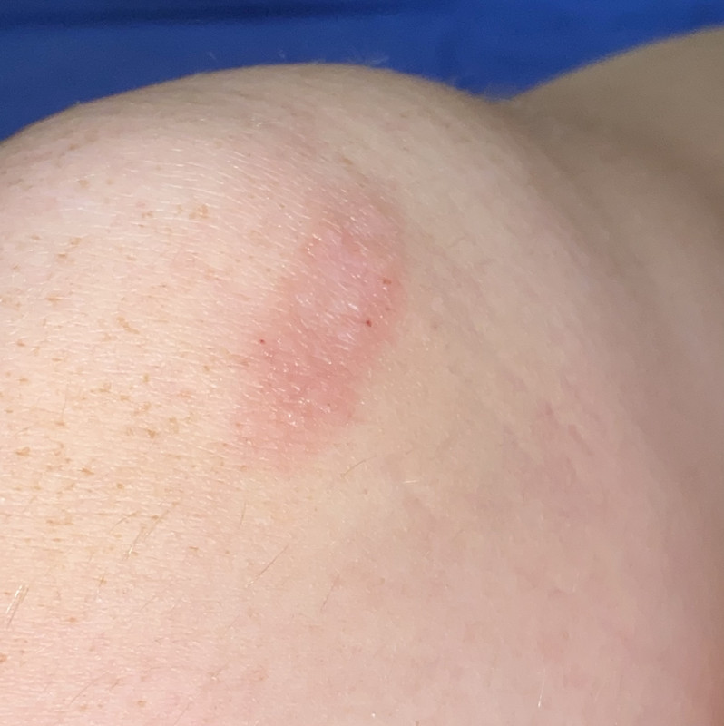 138CCBE4-4608-43AA-B0F5-915832BBDE85