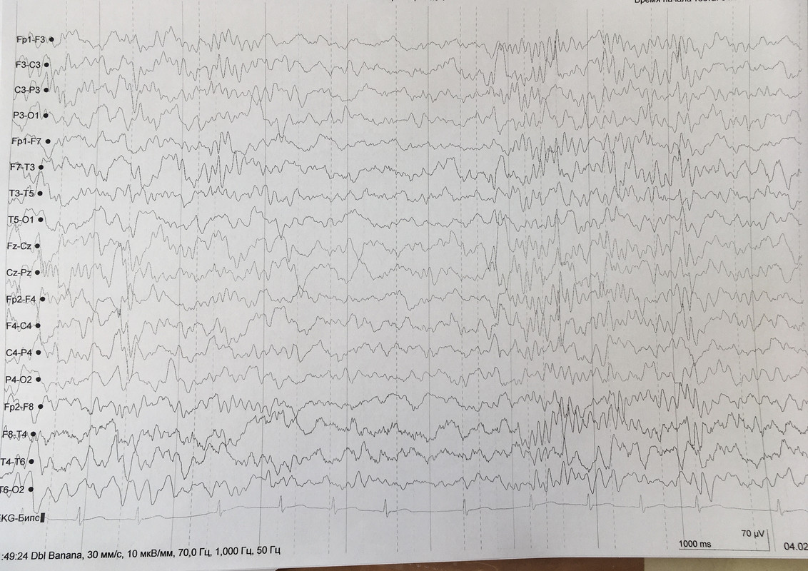 92F38B3C-F9FA-4C39-AC09-6E89A73AC6A1