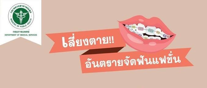 เตือน! จัดฟันแฟชั่นออนไลน์ผิดกฎหมายและอันตราย เสี่ยงติดเชื้อ อันตรายถึงชีวิต