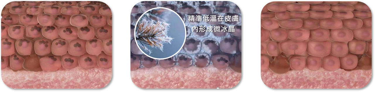 冰息科技示意圖