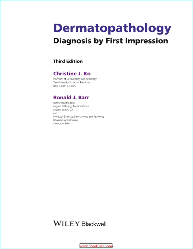 [Image: 6j93rsejm6ut.png]