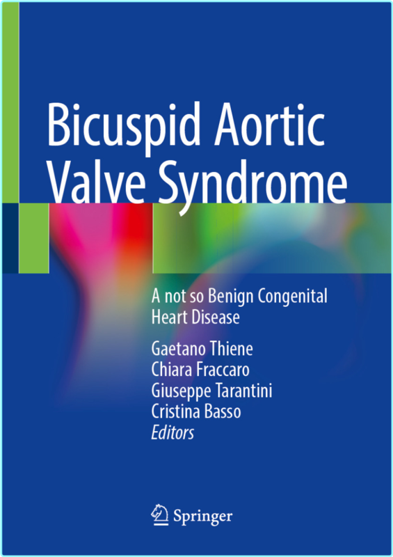 Bicuspid Aortic Valve Syndrome A Not So Benign Congenital Heart Disease (2025) (Gaetano Thiene, Chiara Fraccaro, Giuseppe Tarantini, Cristina Basso)