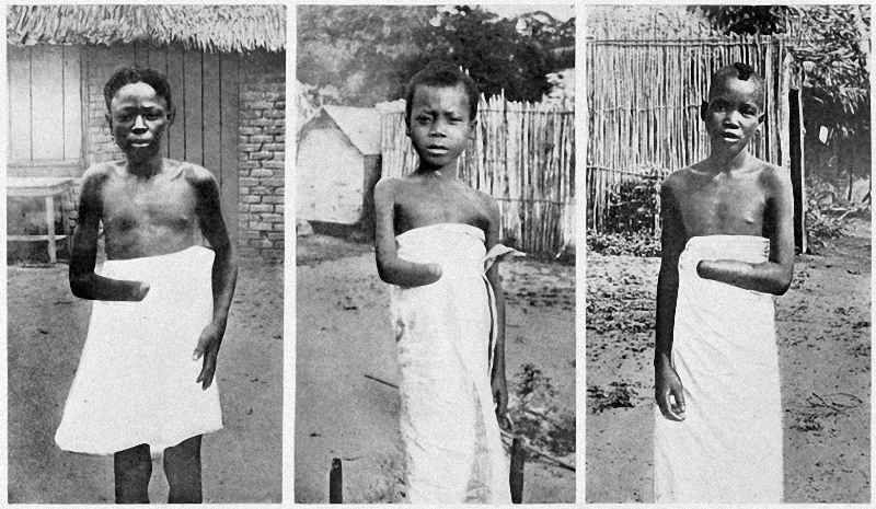 Waarom wordt Belgische Koning Leopold II niet in één adem genoemd met Hitler of Stalin?