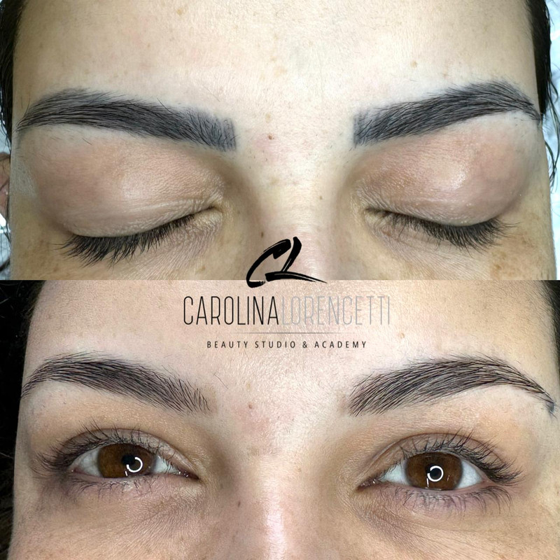 Despigmentação de Sobrancelhas