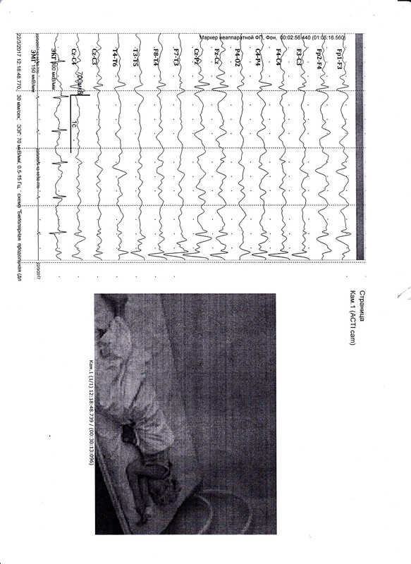 ЭЭг лист5от 03.17