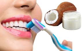 Assessing the Long-Term Periodontal Risks of Using Coconut Oil for Teeth Whitening