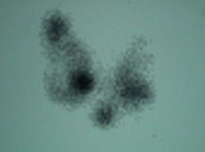 Oncology question 4 image