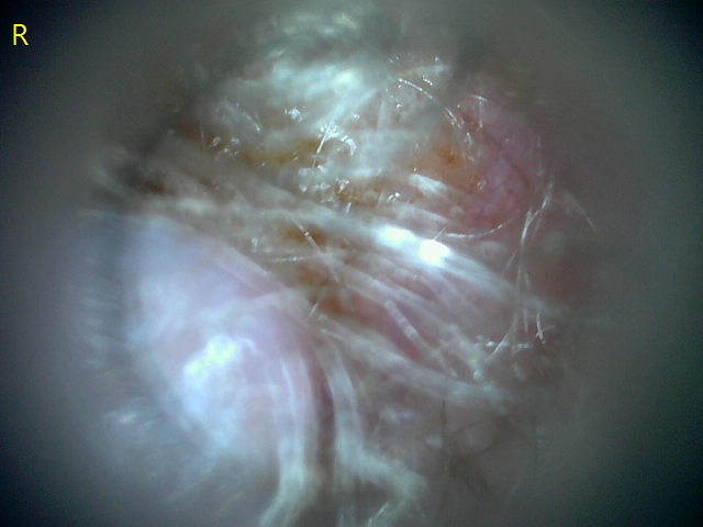 23207 177216 Into CNS 000009