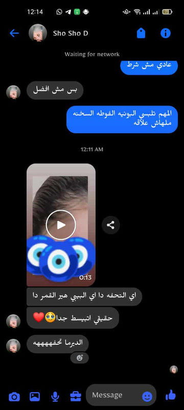 رأي عميلة