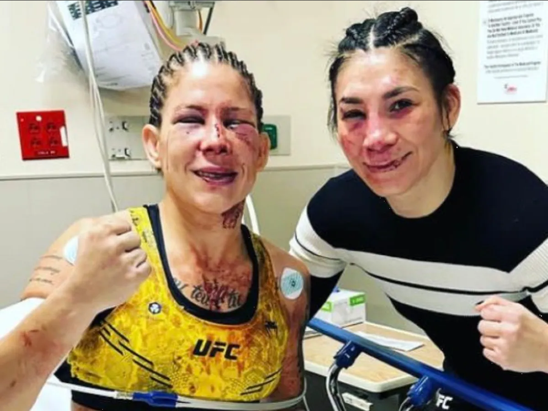 Irene Aldana y Karol Rosa muestran las heridas de la batalla tras UFC 296