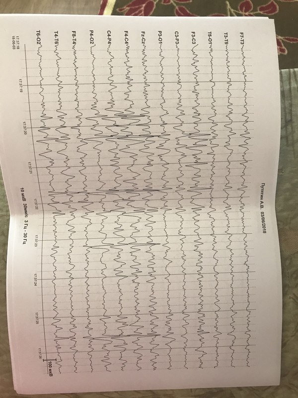 A4EE8147-7D09-43D9-8F7D-AB0316534419