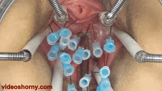 Torture with Needles in the inner of Pussy, the Cervix and Tits