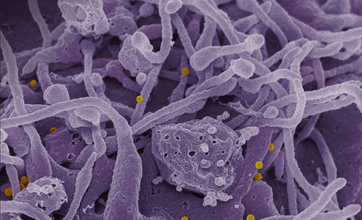 Virus mortal se extiende por Europa y Medio Oriente; expertos temen lo peor
