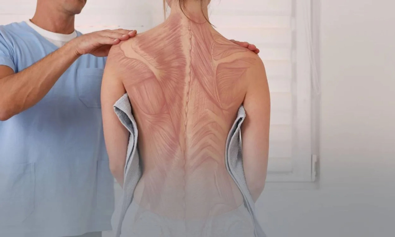 Posture Correction