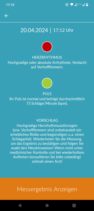 Vorhofflimmern wird angezeigt