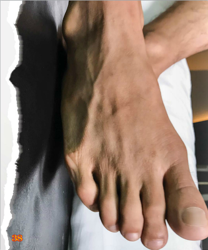 036