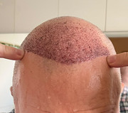 [Imagen: Frontal1.jpg]