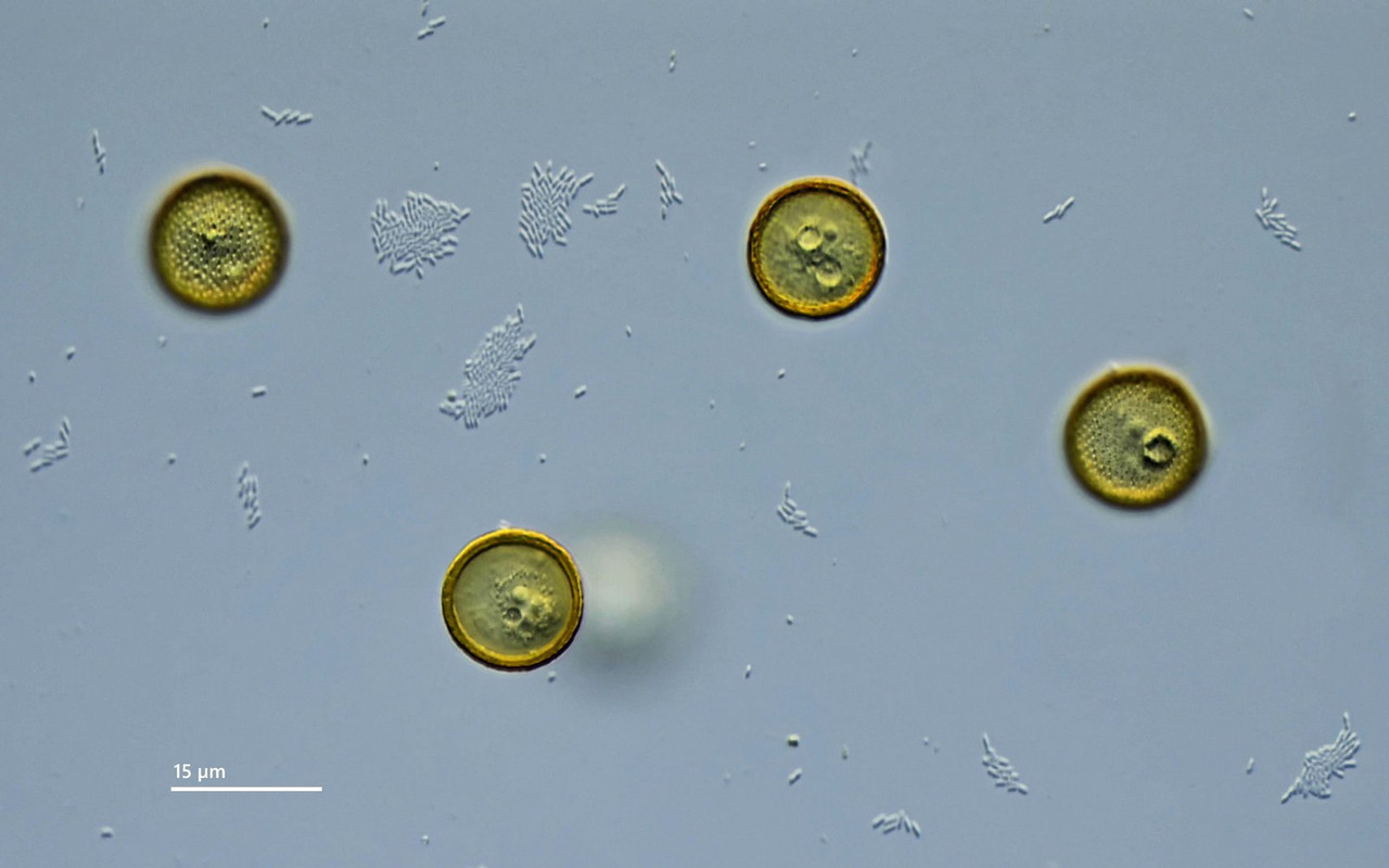 Pyxidicula 02 operculata Käppchen-Amöbe (Kreutz 102) Verschiedene Ebenen DIK 100 Komp 4-Z7