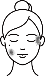 그 외 모든 색소질환