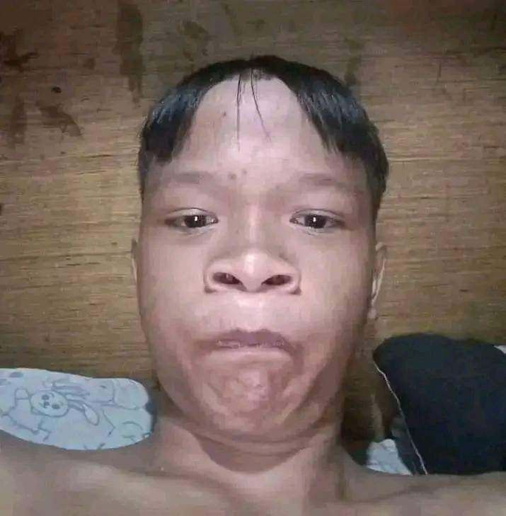 Zonk Foto