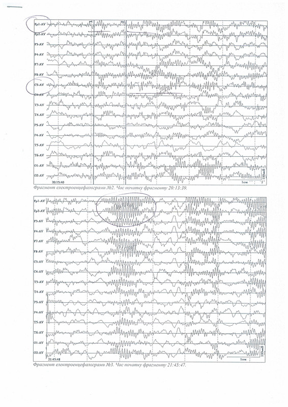 Эхокор стр 3