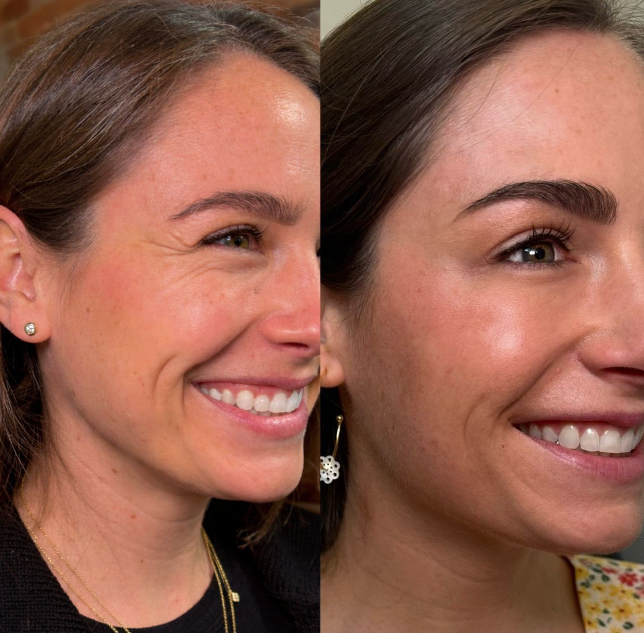 Dermabem Clinical Formulations