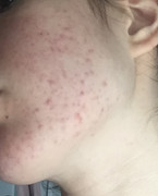 1C5D98CC-77AA-4A97-9921-D817D62CF7EC